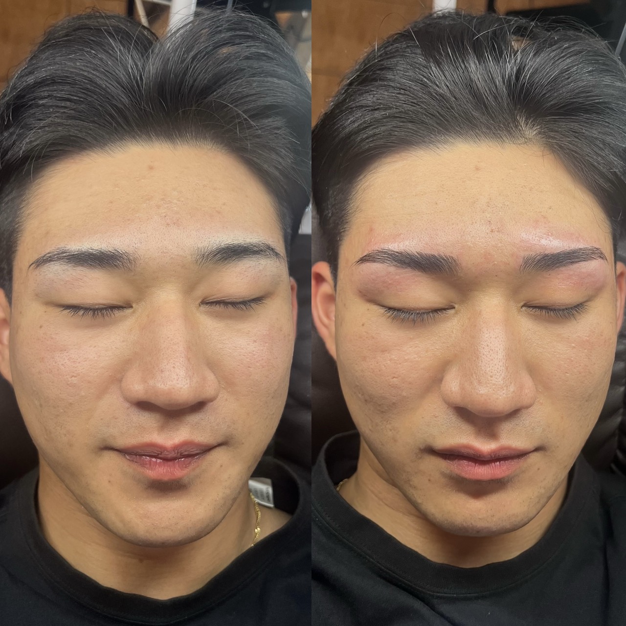 ビフォアアフター