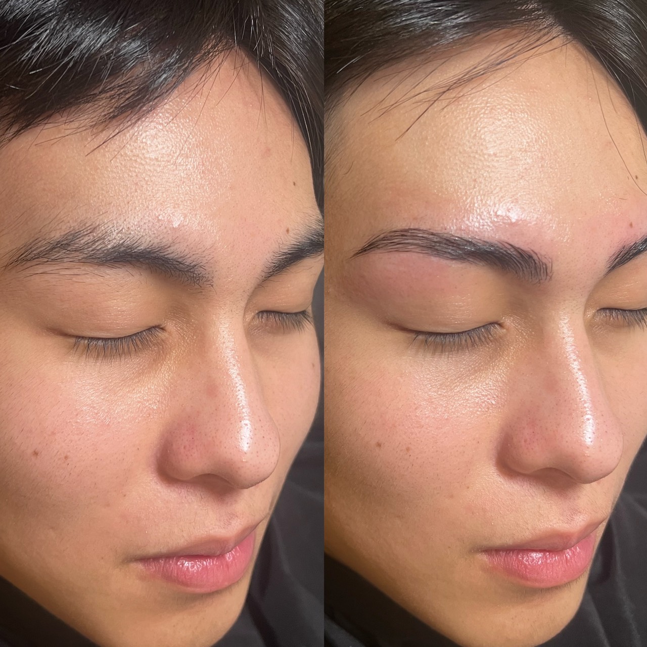 ビフォアアフター